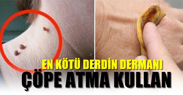 Muz Kabuğuyla Sadece 1 Haftada Çözebileceğiniz 6 Sorun