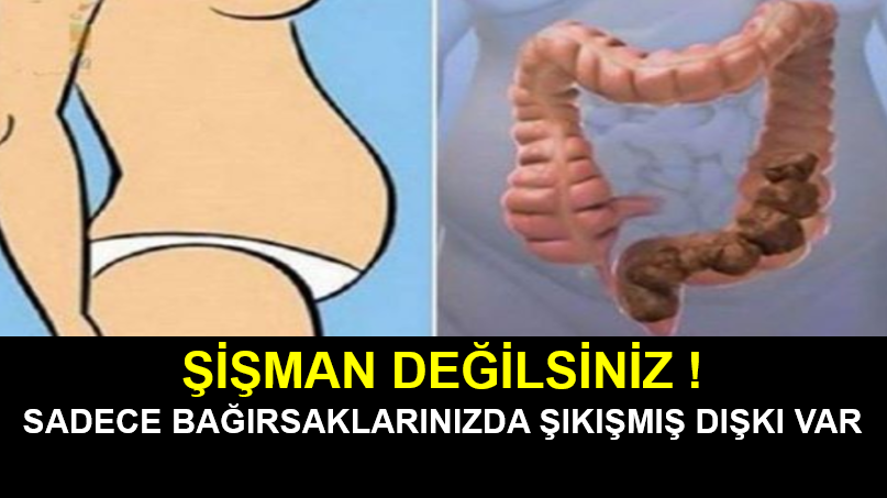 Şişman Değilsiniz - Kurtulmanın Yolu basit