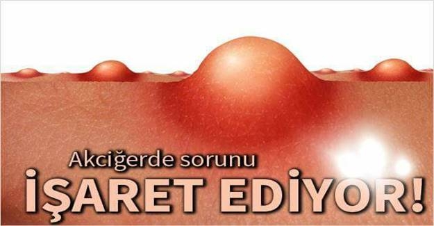 Akciğer Sağlığınızı Koruyun -