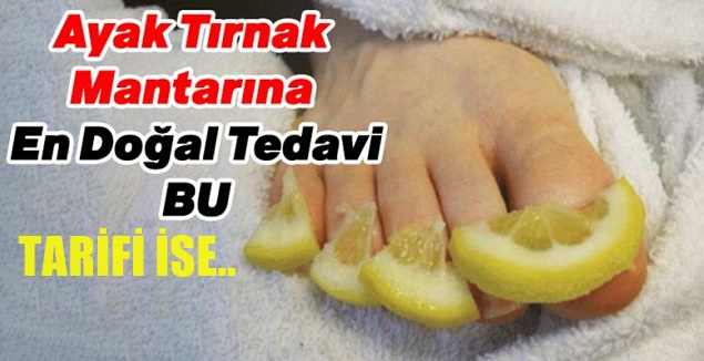 Tırnak mantarını 1 saat içerisinde yok eden karışım tarifi