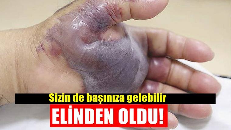 ÇİĞ YEDİ, ELİNDEN OLDU