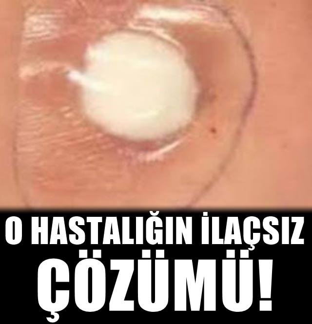 Bu sırrı hiç bir doktor vermez! Göbek deliğine pamuk koyup bantlarsanız.