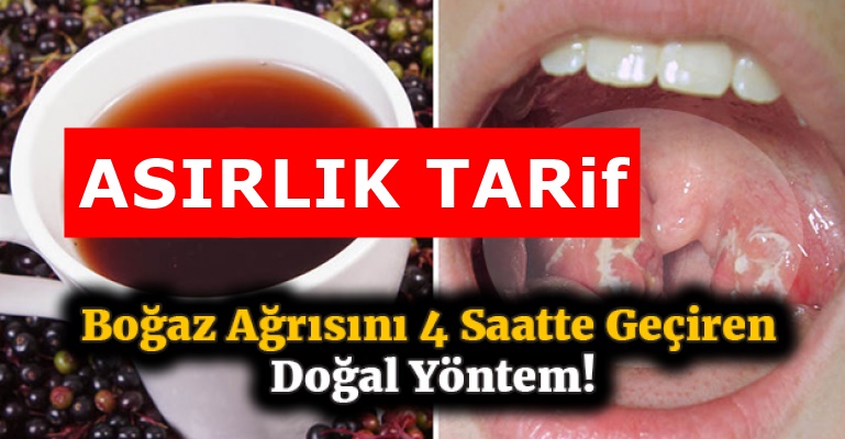 İltihaplı bademcikleri antibiyotik kullanmadan iyileştiren doğal tarife