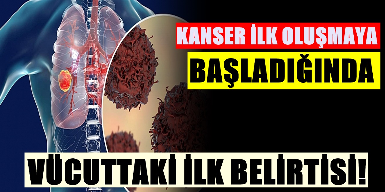Ölümcül Kanserin Aylar Önceden Ortaya Çıkan ilk Belirtisi Belli Oldu! Vücutta ilk...