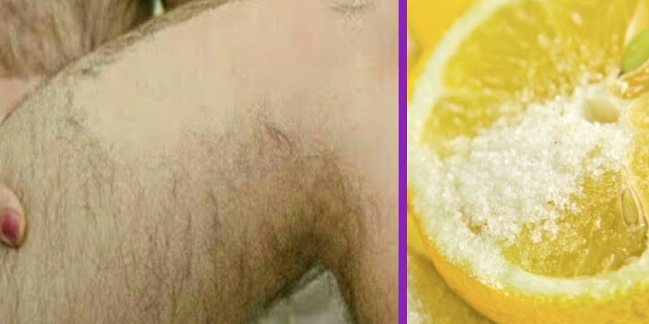 Limon + şekerle gelen etki... Karıştırıp yüzünüze sürmeniz yetiyor